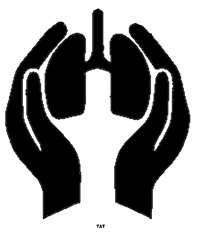 choroby płuc, guz płuca, rak płuca, torakochirurg